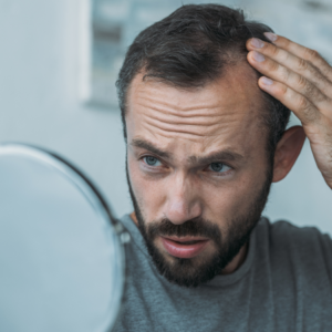 Article: Hair loss Solutions. Pic - "Man examining his hairline in a mirror."